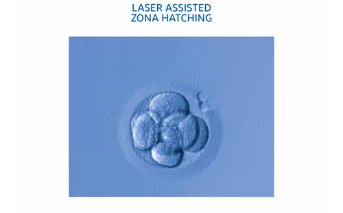 Assisted Hatching