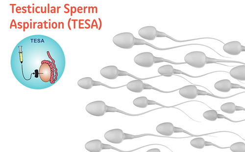 TESA