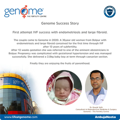 First attempt IVF success with endometriosis and large fibroid
