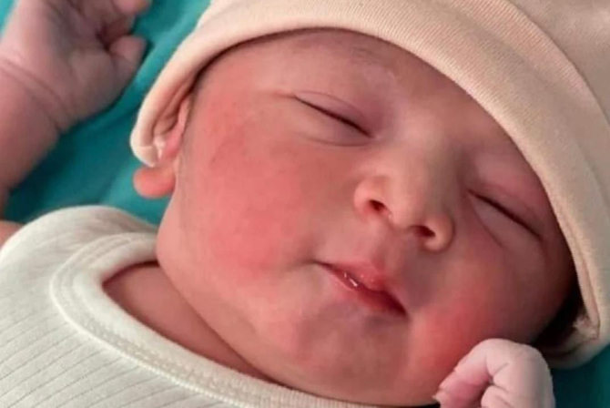 Our first successful 'Trans Myometrial Embryo Transfer'- a RARE Procedure performed by Dr. Sujoy Dasgupta, Director Clinical Services at Genome.