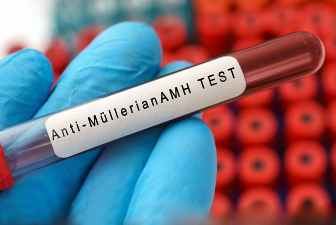 Understanding AMH