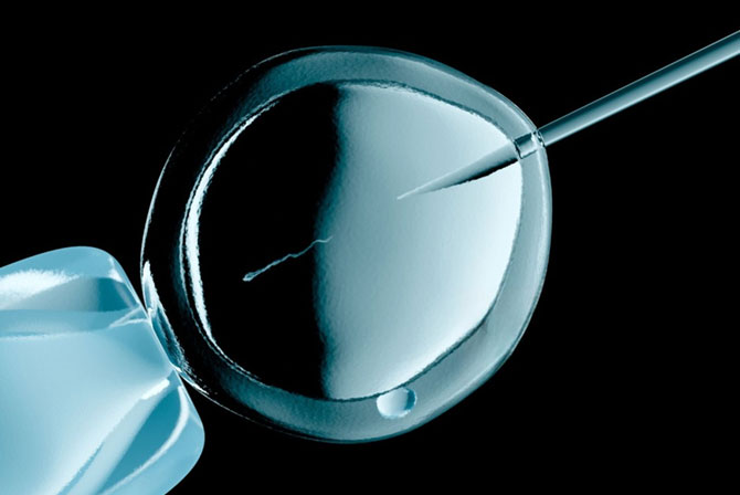 IVF Centre: A Beacon of Hope for Modern Parenthood
